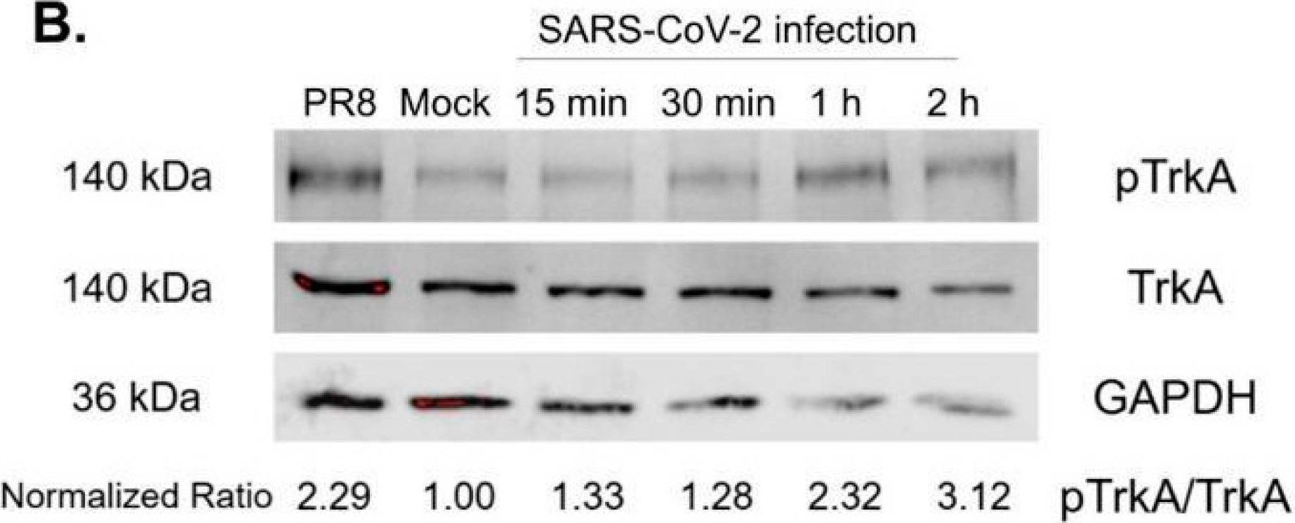 Fig.3.B showing Western Blotting from the publication: Cellular Receptor Tyrosine Kinase Signaling Plays Important Roles in SARS-CoV-2 Infection.