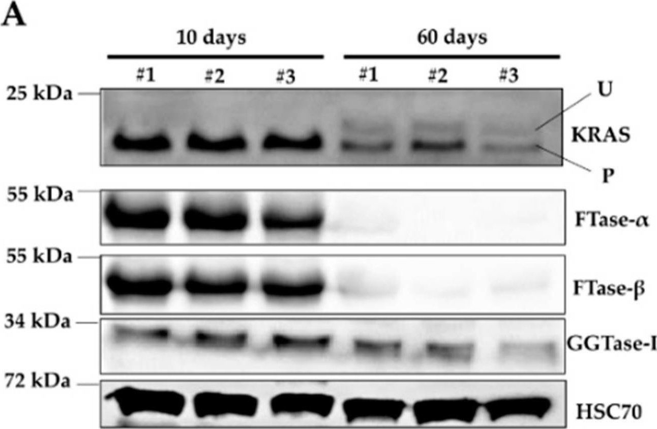 Fig.7.A showing Western Blotting in a Mus musculus (House mouse) sample from the publication: A Novel KRAS Antibody Highlights a Regulation Mechanism of Post-Translational Modifications of KRAS during Tumorigenesis.