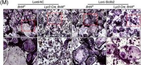 Fig.5.M showing Immunohistochemistry in a Mus musculus (House mouse) sample from the publication: Loss of Brd4 alleviates pathological bone loss via Slc9b2 suppression in osteoclastogenesis.