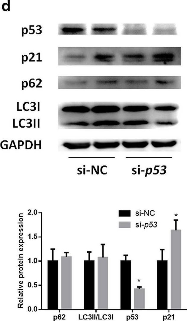 Fig.2.D showing Western Blotting from the publication: Silencing of functional p53 attenuates NAFLD by promoting HMGB1-related autophagy induction.