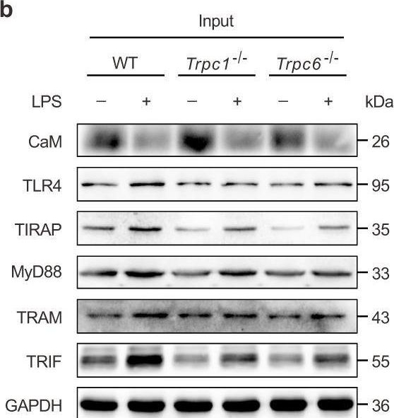 Fig.4.B showing Western Blotting in a Mus musculus (House mouse) sample from the publication: TRPC channels blockade abolishes endotoxemic cardiac dysfunction by hampering intracellular inflammation and Ca2+ leakage.