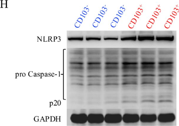 Fig.2.H showing Western Blotting from the publication: Novel approach to alleviate lupus nephritis: targeting the NLRP3 inflammasome in CD8+CD69+CD103+ TRM cells.