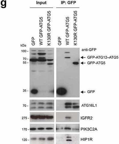Fig.2.G showing Western Blotting from the publication: The ATG5 interactome links clathrin-mediated vesicular trafficking with the autophagosome assembly machinery.