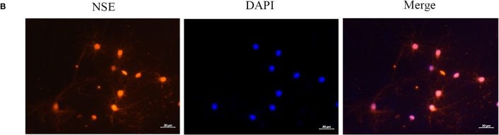 Fig.1.B showing Immunocytochemistry-immunofluorescence in a Rattus norvegicus (Rat) sample from the publication: Astrocyte-derived exosomal miR-378a-5p mitigates cerebral ischemic neuroinflammation by modulating NLRP3-mediated pyroptosis.