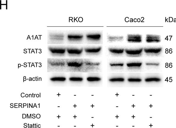 Fig.5.H showing Western Blotting from the publication: CEBPB-mediated upregulation of SERPINA1 promotes colorectal cancer progression by enhancing STAT3 signaling.