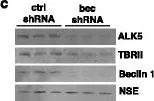 Fig.3.C showing Western Blotting in a Homo sapiens (Human) sample from the publication: Beclin 1 regulates neuronal transforming growth factor-β signaling by mediating recycling of the type I receptor ALK5.