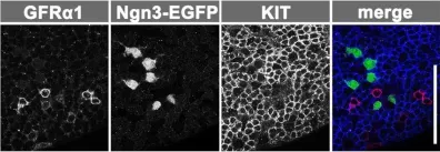 Fig.1.C showing Immunofluorescence in a Mus musculus (House mouse) sample from the publication: Hierarchical differentiation competence in response to retinoic acid ensures stem cell maintenance during mouse spermatogenesis.