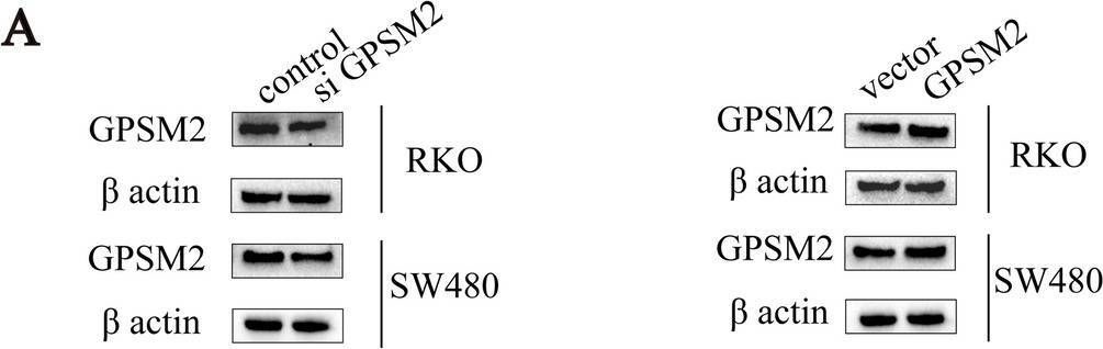 Fig.12.A showing Western Blotting in a Homo sapiens (Human) sample from the publication: Comprehensive Analysis of GPSM2: From Pan-Cancer Analysis to Experimental Validation.