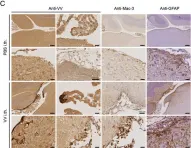 Fig.1.C showing Immunohistochemistry from the publication: α4-integrins control viral meningoencephalitis through differential recruitment of T helper cell subsets.
