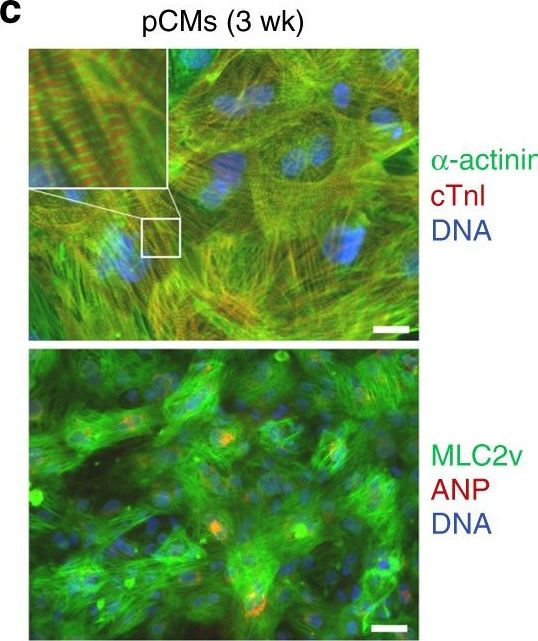 Fig.2.C showing Immunocytochemistry-immunofluorescence in a Homo sapiens (Human) sample from the publication: Cardiogenic programming of human pluripotent stem cells by dose-controlled activation of EOMES.