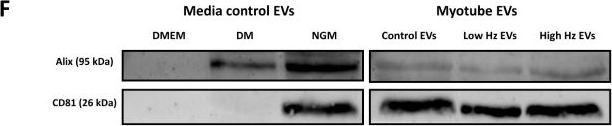 Fig.2.F showing Western Blotting in a Mus musculus (House mouse) sample from the publication: Small Extracellular Vesicle Release Following Electrical Pulse Stimulation of C2C12 Myotubes: Effects on microRNA Cargo and Myoblast Migration and Differentiation.