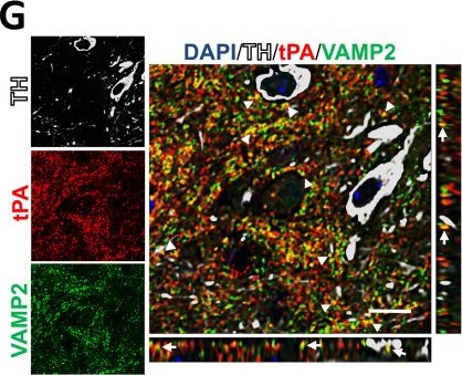 Fig.1.G showing Immunohistochemistry-immunofluorescence from the publication: The interaction of tPA with NMDAR1 drives neuroinflammation and neurodegeneration in α-synuclein-mediated neurotoxicity.