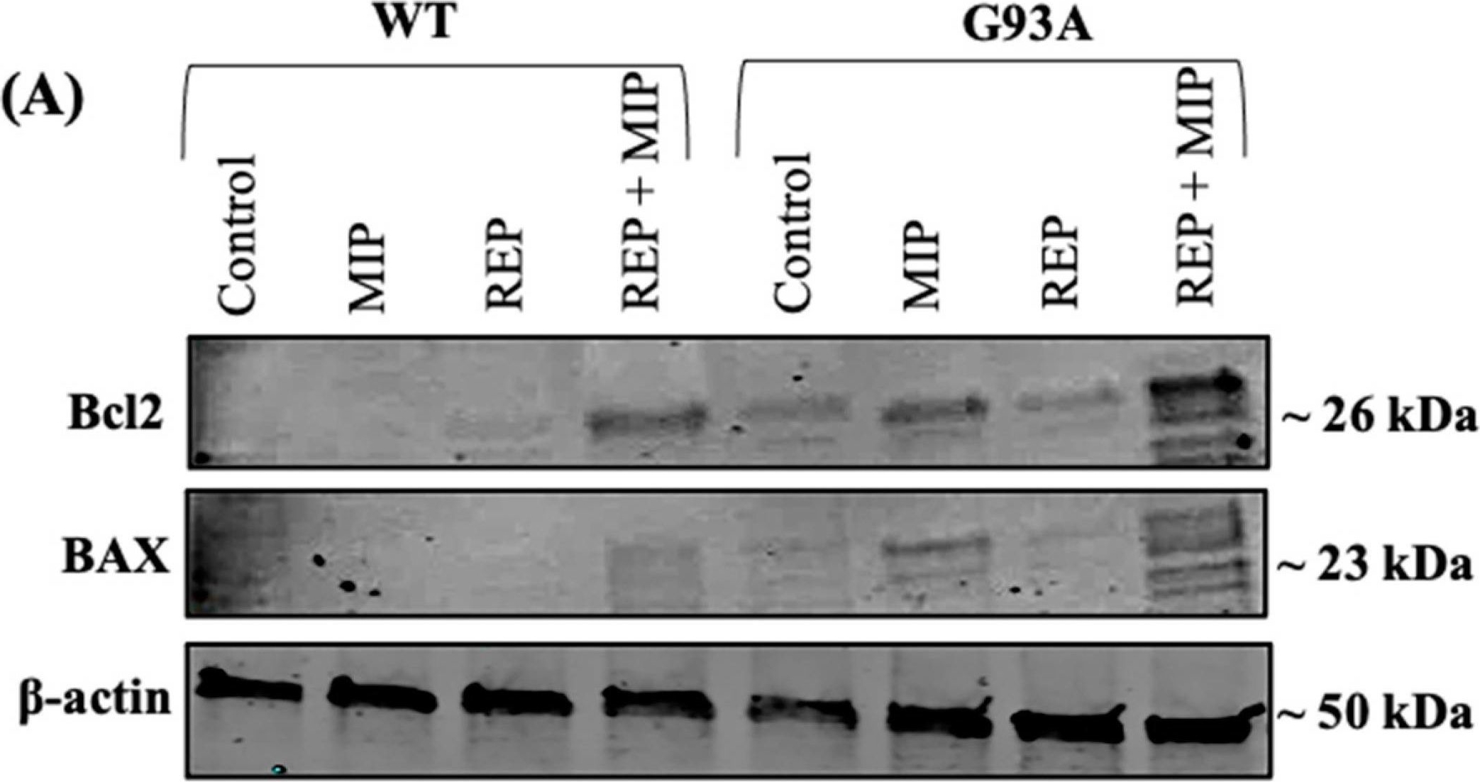 Fig.7.A showing Western Blotting in a Homo sapiens (Human) sample from the publication: CXCR2 Is Deregulated in ALS Spinal Cord and Its Activation Triggers Apoptosis in Motor Neuron-Like Cells Overexpressing hSOD1-G93A.