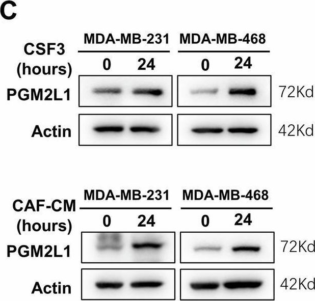 Fig.4.C showing Western Blotting from the publication: Cancer-associated fibroblasts secrete CSF3 to promote TNBC progression via enhancing PGM2L1-dependent glycolysis reprogramming.