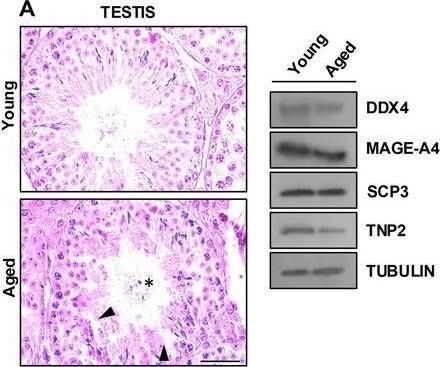 Fig.1.A showing Western Blotting in a Mus musculus (House mouse) sample from the publication: Deciphering the Contribution of Circular RNAs to Age-Related Decline in Sertoli Cell Survivor.