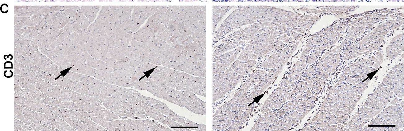 Fig.6.C showing Immunohistochemistry from the publication: BMP2 gene transfer induces pericardial effusion and inflammatory response in the ischemic porcine myocardium.