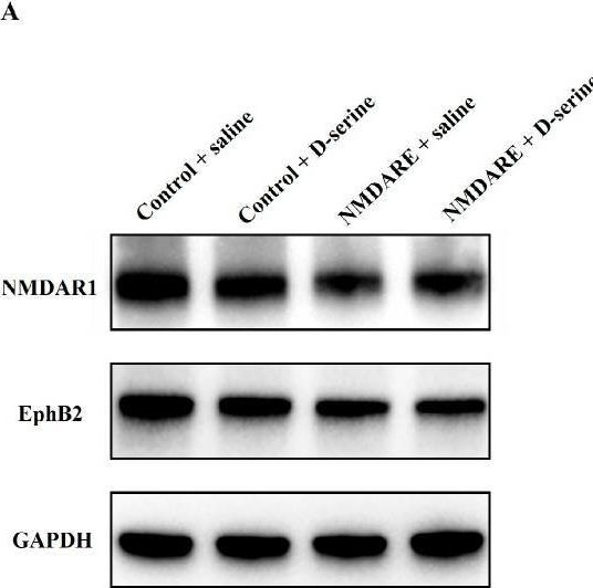 Fig.5.A showing Western Blotting from the publication: D-Serine May Ameliorate Hippocampal Synaptic Plasticity Impairment Induced by Patients' Anti-N-methyl-D-aspartate Receptor Antibodies in Mice.