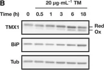 Fig.3.B showing Western Blotting in a Homo sapiens (Human) sample from the publication: Transmembrane thioredoxin-related protein TMX1 is reversibly oxidized in response to protein accumulation in the endoplasmic reticulum.