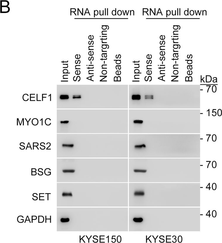 Fig.3.B showing Western Blotting from the publication: tRNA-derived fragment tRF-24 drives CELF1 phase separation to promote oncogenic splicing in esophageal squamous cell carcinoma.