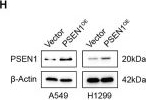 Fig.8.H showing Western Blotting in a Homo sapiens (Human) sample from the publication: Novel prognostic signature unveils PSEN1 contributes to depression-induced lung adenocarcinoma progression.