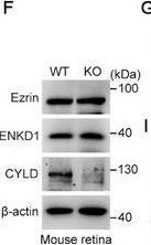 Fig.5.F showing Western Blotting from the publication: CYLD Maintains Retinal Homeostasis by Deubiquitinating ENKD1 and Promoting the Phagocytosis of Photoreceptor Outer Segments.