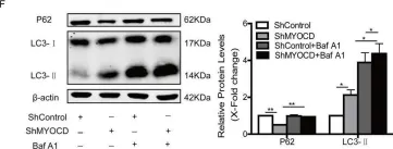 Fig.1.F showing Western Blotting in a Homo sapiens (Human) sample from the publication: Myocardin/microRNA-30a/Beclin1 signaling controls the phenotypic modulation of vascular smooth muscle cells by regulating autophagy.