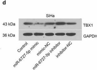 Fig.5.D showing Western Blotting from the publication: T-box transcription factor TBX1, targeted by microRNA-6727-5p, inhibits cell growth and enhances cisplatin chemosensitivity of cervical cancer cells through AKT and MAPK pathways.