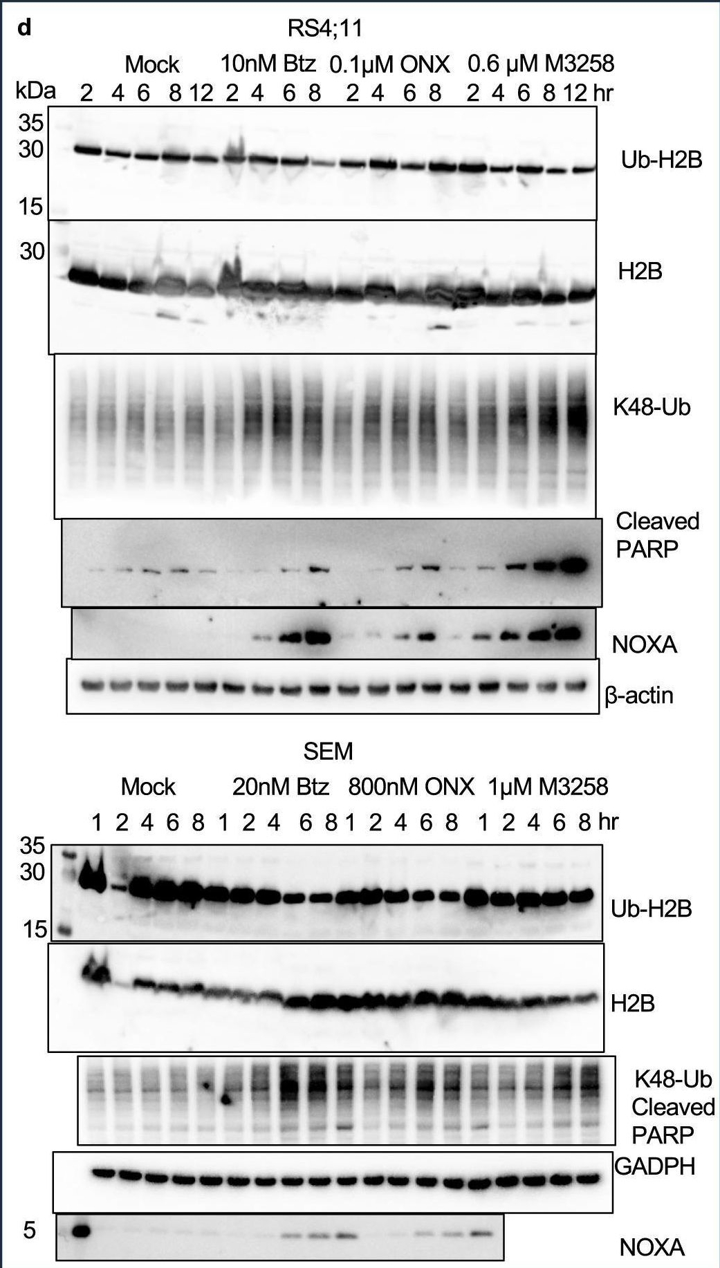 Fig.5.D showing Western Blotting in a Mus musculus (House mouse) sample from the publication: Highly specific Immunoproteasome inhibitor M3258 induces proteotoxic stress and apoptosis in KMT2A::AFF1 driven acute lymphoblastic leukemia.