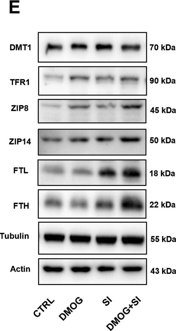Fig.4.E showing Western Blotting in a Homo sapiens (Human) sample from the publication: Hypoxia aggravates ferroptosis in RPE cells by promoting the Fenton reaction.
