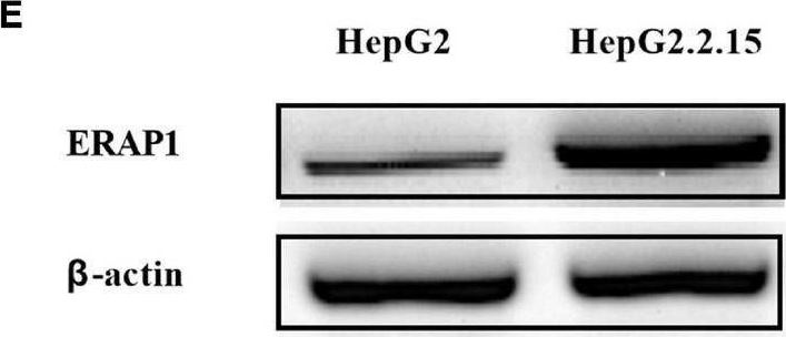 Fig.1.E showing Western Blotting in a Homo sapiens (Human) sample from the publication: Endoplasmic Reticulum Aminopeptidase 1 Is Involved in Anti-viral Immune Response of Hepatitis B Virus by Trimming Hepatitis B Core Antigen to Generate 9-Mers Peptides.