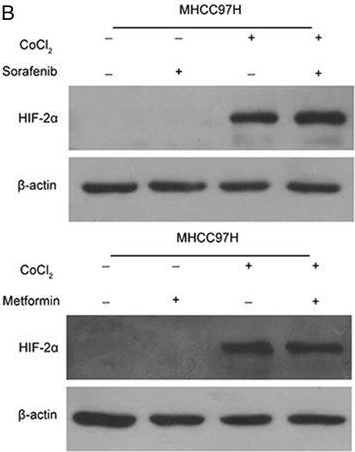 Fig.1.B showing Western Blotting in a Homo sapiens (Human) sample from the publication: Metformin sensitizes sorafenib to inhibit postoperative recurrence and metastasis of hepatocellular carcinoma in orthotopic mouse models.