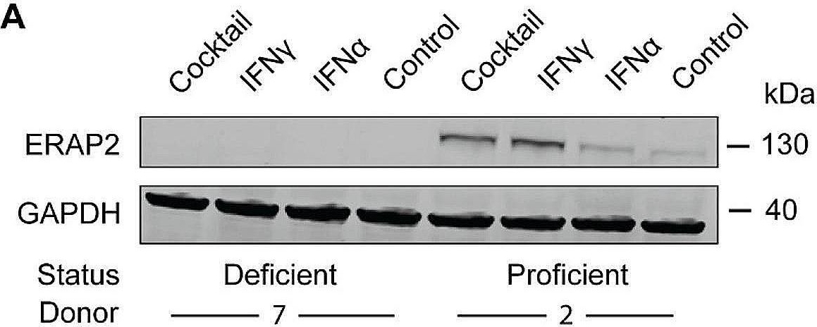 Fig.4.A showing Western Blotting in a Homo sapiens (Human) sample from the publication: The effect of rs2910686 on ERAP2 expression in IBD and epithelial inflammatory response.