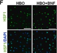 Fig.3.F showing Immunocytochemistry-immunofluorescence from the publication: The CYP1A-HSF1 axis alleviates mitochondrial oxidative stress to limit HBO-induced lung endothelial barrier damage.
