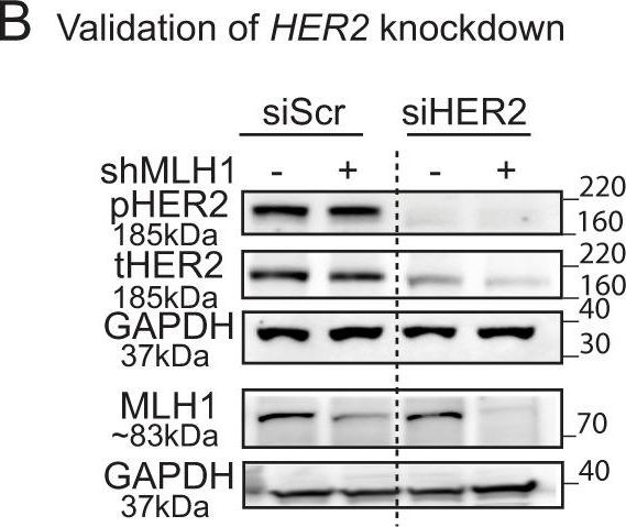 Fig.4.B showing Western Blotting in a Homo sapiens (Human) sample from the publication: Mismatch repair deficiency predicts response to HER2 blockade in HER2-negative breast cancer.