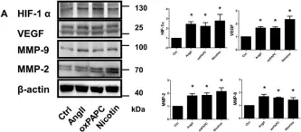 Fig.1.A showing Western Blotting from the publication: Inhibition of hypoxia inducible factor-1α attenuates abdominal aortic aneurysm progression through the down-regulation of matrix metalloproteinases.