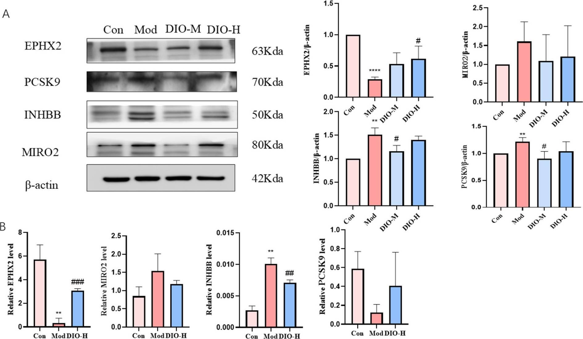 Fig.5.A showing Western Blotting from the publication: Protective Effects of Dioscin and Diosgenin on Plateau Hyperuricemia by Attenuating Renal Inflammation via EPHX2.