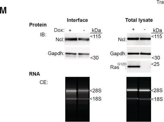 Fig.1.M showing Western Blotting from the publication: An ERK1/2-driven RNA-binding switch in nucleolin drives ribosome biogenesis and pancreatic tumorigenesis downstream of RAS oncogene.