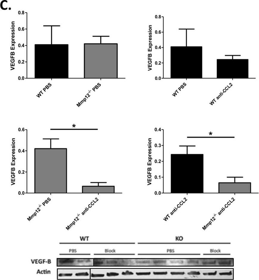 Fig.8.C showing Western Blotting in a Mus musculus (House mouse) sample from the publication: MMP12 Inhibits Corneal Neovascularization and Inflammation through Regulation of CCL2.