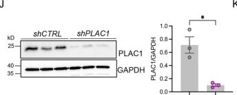Fig.5.J showing Western Blotting from the publication: Fundamental and unique roles of PLAC1 in the regulation of rat and human trophoblast cell development.
