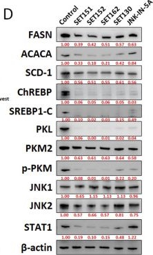 Fig.1.D showing Western Blotting in a Homo sapiens (Human) sample from the publication: Targeting PKLR and lipogenic enzymes through JNK inhibition to develop a therapeutic strategy for MASLD and MASH.