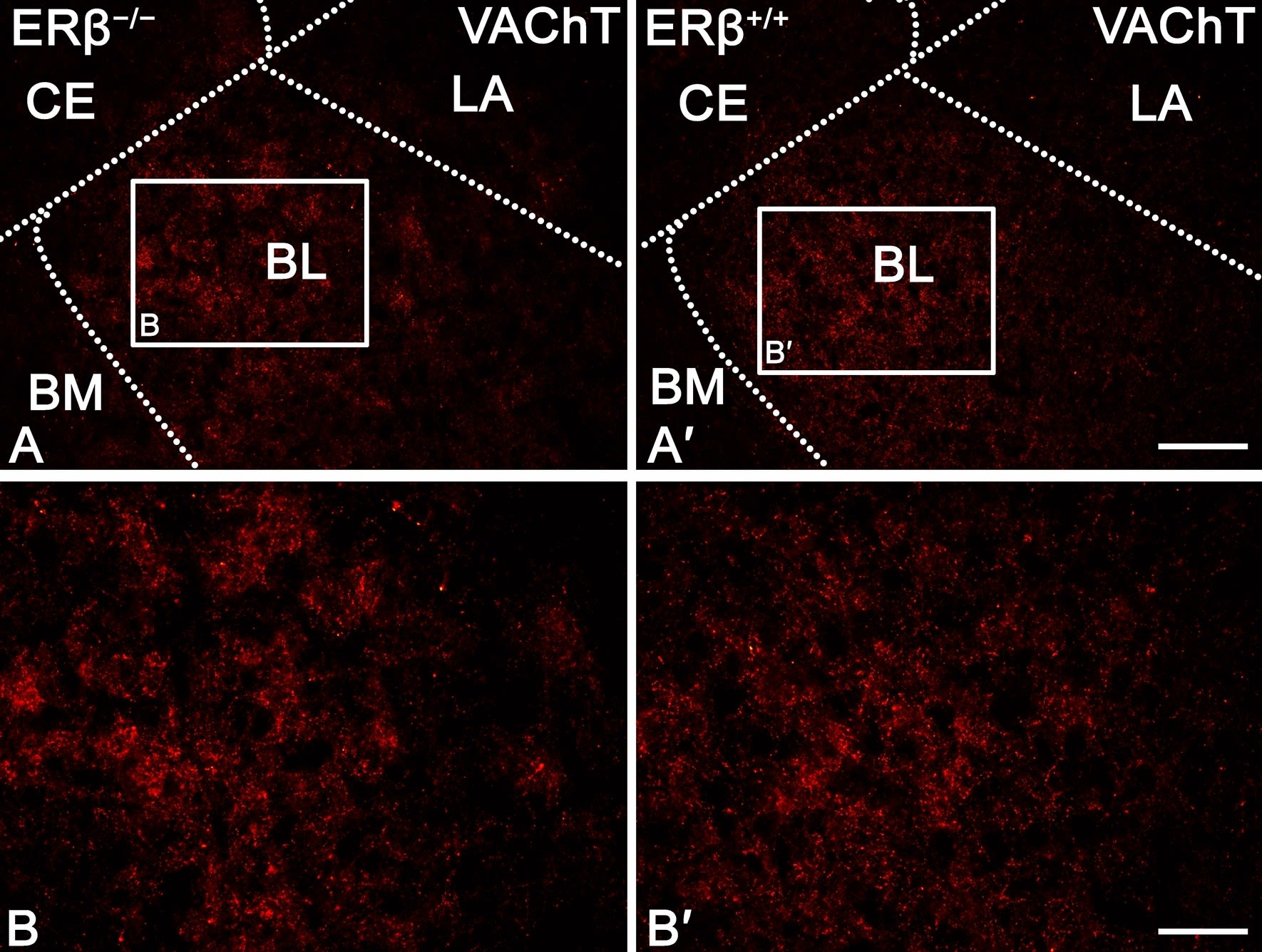Fig.7.A,B showing Immunohistochemistry-immunofluorescence in a Mus musculus (House mouse) sample from the publication: Dopaminergic and cholinergic modulation of the amygdala is altered in female mice with oestrogen receptor β deprivation.