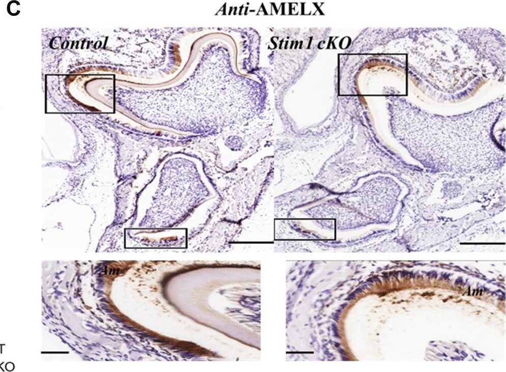 Fig.7.C showing Immunohistochemistry in a Mus musculus (House mouse) sample from the publication: Deciphering the functions of Stromal Interaction Molecule-1 in amelogenesis using AmelX-iCre mice.