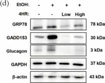 Fig.6.D showing Western Blotting in a Mus musculus (House mouse) sample from the publication: 4-Hexylresorcinol Attenuates Ethanol-Induced Hepatic and Pancreatic Injury by Modulating Metabolic Dysfunction and Endoplasmic Reticulum Stress.