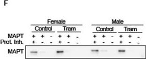 chien様 Tau (D1M9X) XP® Rabbit mAb | Cell Signaling Technology