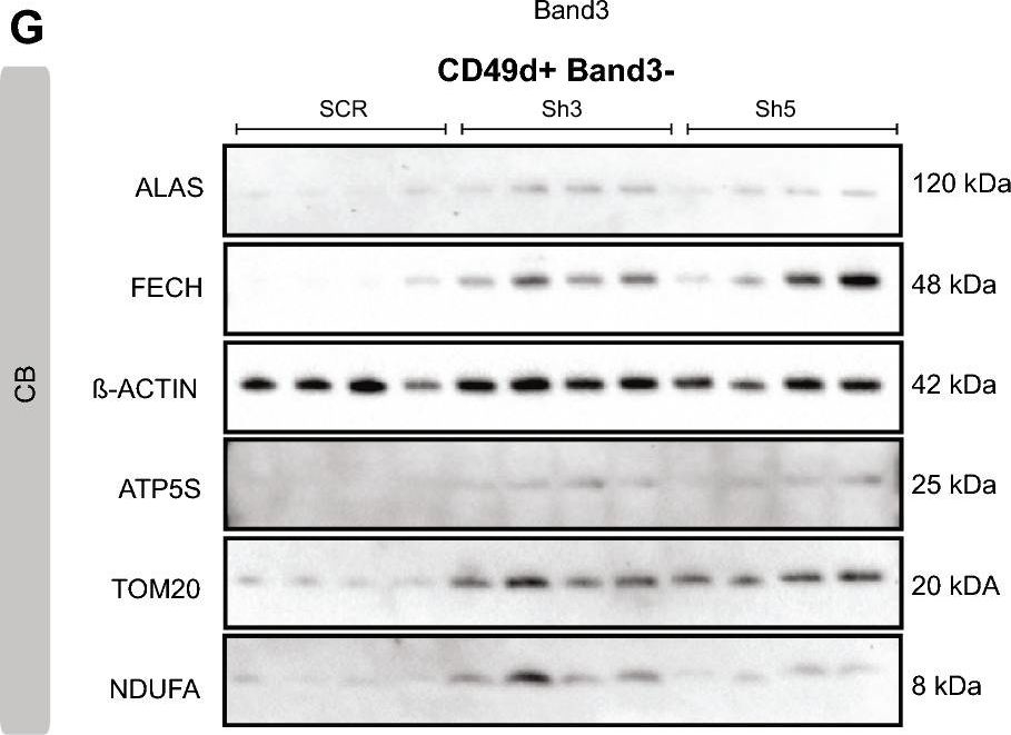 Fig.4.G showing Western Blotting in a Homo sapiens (Human) sample from the publication: Decreased PGC1β expression results in disrupted human erythroid differentiation, impaired hemoglobinization and cell cycle exit.