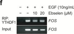 Fig.2.F showing Western Blotting from the publication: Ebselen Suppresses Breast Cancer Tumorigenesis by Inhibiting YTHDF1-Mediated c-Fos Expression.