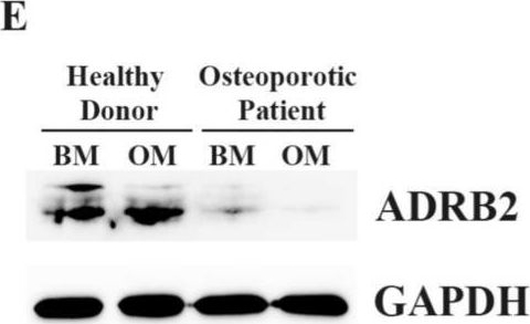 Fig.2.E showing Western Blotting in an Armoracia rusticana (Horseradish) sample from the publication: Unraveling the Mechanism of Impaired Osteogenic Differentiation in Osteoporosis: Insights from ADRB2 Gene Polymorphism.