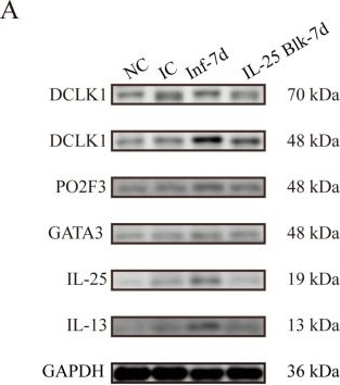 Fig.3.A showing Western Blotting in a Mus musculus (House mouse) sample from the publication: Tuft-cell-derived IL-25 regulates intestinal ILC2 in response to Brucella infection.