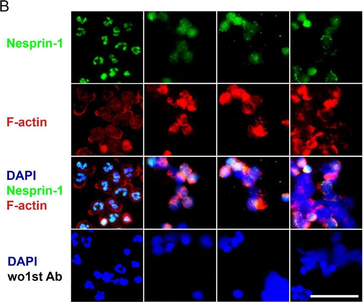Fig.5.B showing Immunocytochemistry-immunofluorescence in a Homo sapiens (Human) sample from the publication: Calpain-1 weakens the nuclear envelope and promotes the release of neutrophil extracellular traps.