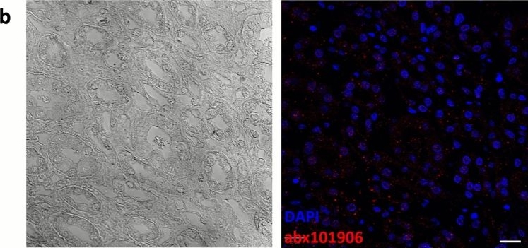 Fig.2.B showing Immunohistochemistry-immunofluorescence from the publication: Validation and performance assessment of a commercial anti-peroxidasin antibody.